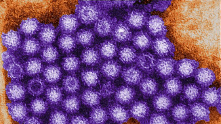 The norovirus causes sickness and diarrohoea