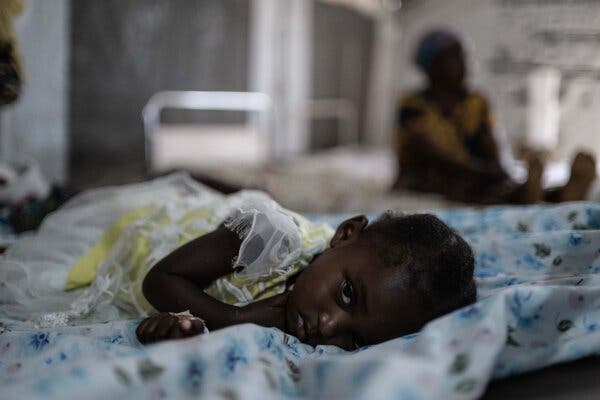 A close-up view of a young girl in a frilly white and yellow dress resting on a hospital bed in an mpox ward in the Democratic Republic of Congo.