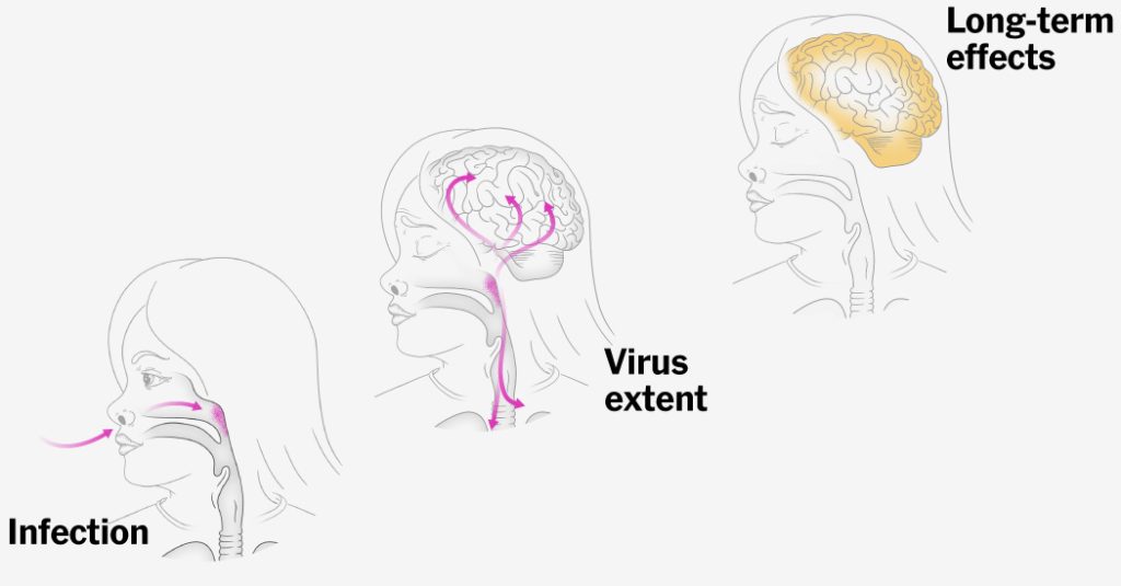 2025-03-20-measles-emma-index-facebookjumbo-v5